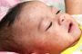 European Countries Lose Measles Elimination Status